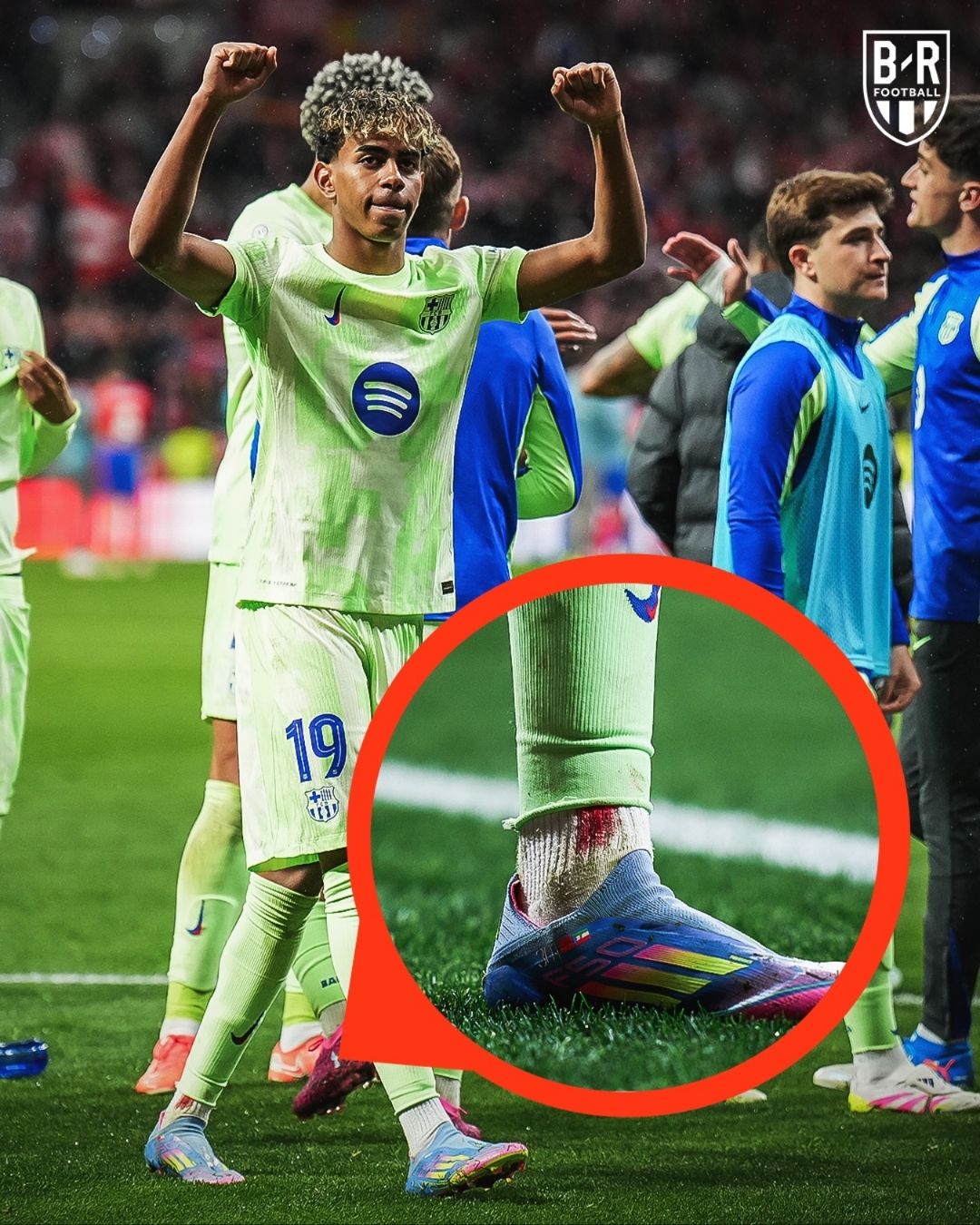 vsports体育-马赛中场多次突破出色表现，让对手手足无措-第2张图片-V体育